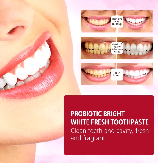 Sp-4 Probiotic Stain Removing Toothpaste - Free Delivery